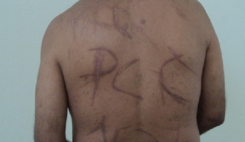Torturado durante rebelião em Cascavel, preso tem sigla do PCC escrita nas costas e receberá R$ 35 mil