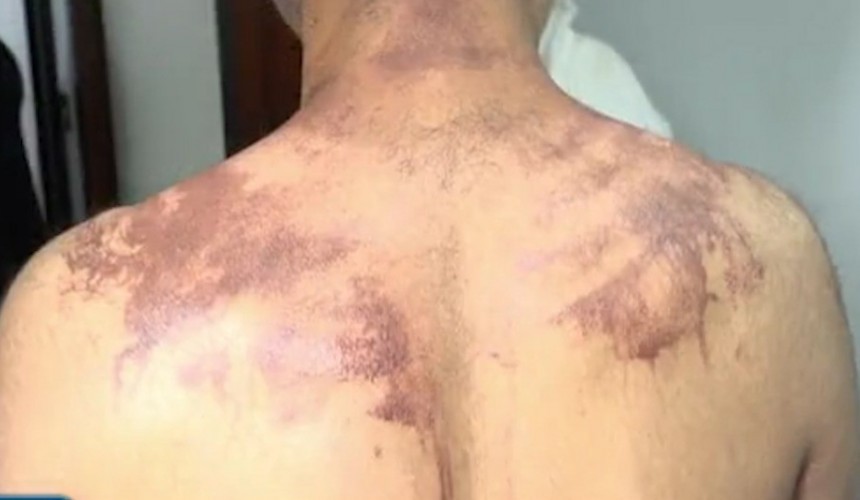 Quatro pessoas são presas por trote que deixou alunos feridos em Palotina