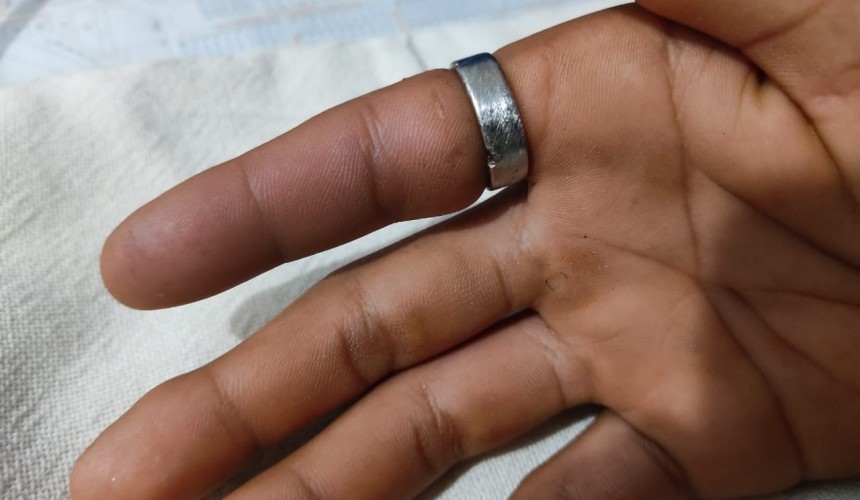 Bombeiros são acionados para retirar anel preso no dedo de adolescente em Capitão