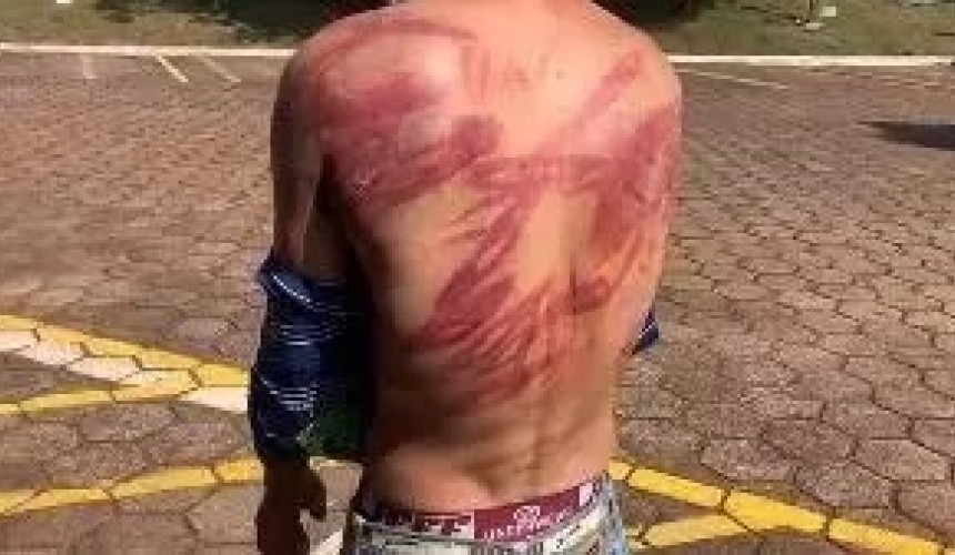 Homem que foi agredido pelo irmão em Cascavel registra boletim de ocorrência