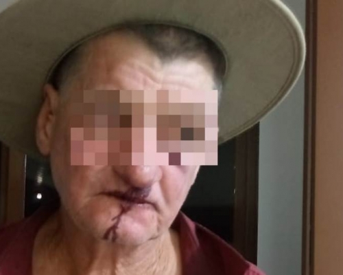 Idoso diz ter sido agredido por vereador em Nova Prata do Iguaçu